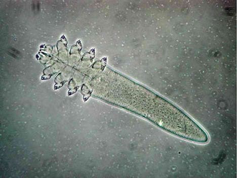 Microscopic view of a Demodex folliculorum mite, which can cause skin demodicosis and eyelid inflammation.